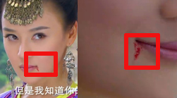 左右傷口分不清楚